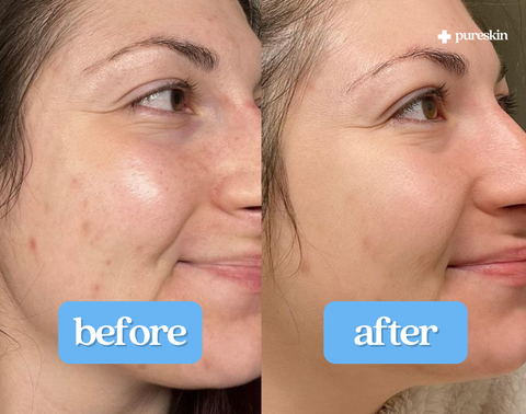 "My skin has never felt cleaner! And I've tried like every product out there."