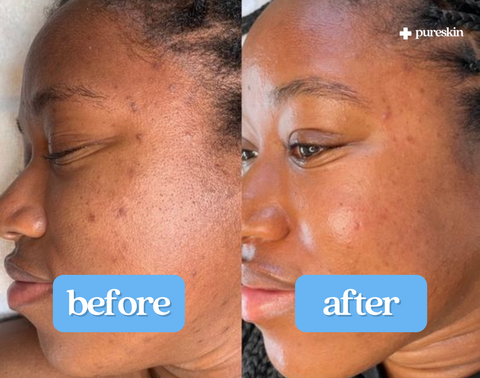 "These transformed my face better than I could have imagined."